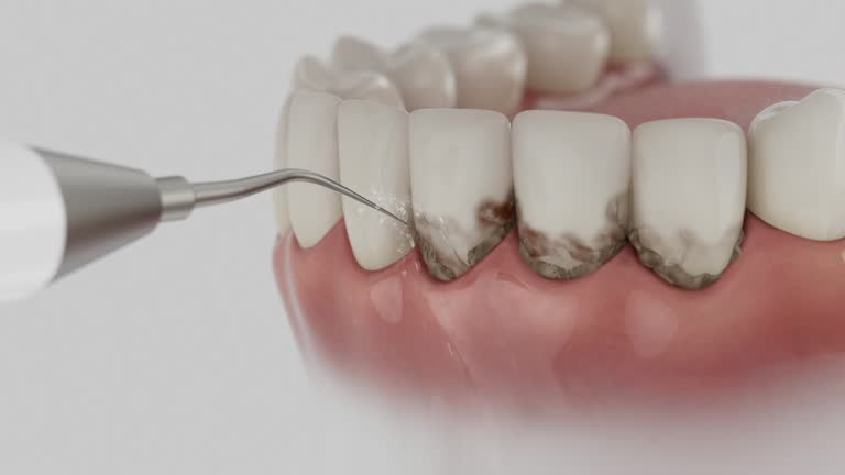 Reliable Emergency Dentist contractor in Seward, NE by Smile Center Dentistry